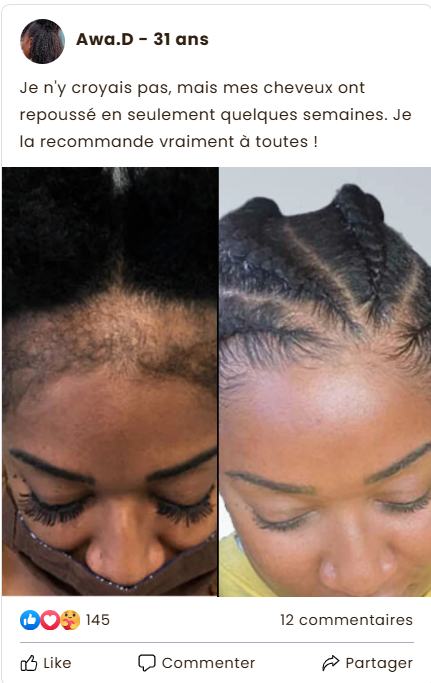 Disaar – Huile Anti-Chute 100% Naturelle. Résultats visibles en 4 semaines.
