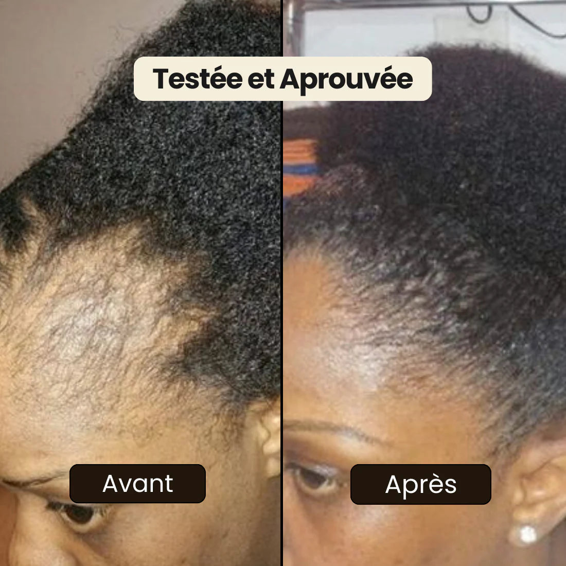 Disaar – Huile Anti-Chute 100% Naturelle. Résultats visibles en 4 semaines.