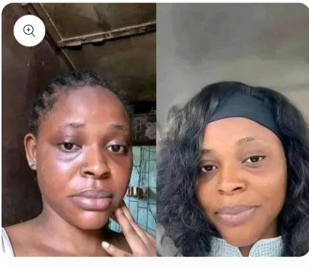 Savon Kojic Éclat Naturel – Ta Peau d’une Douceur Lumineuse, Éclatante et Lisse