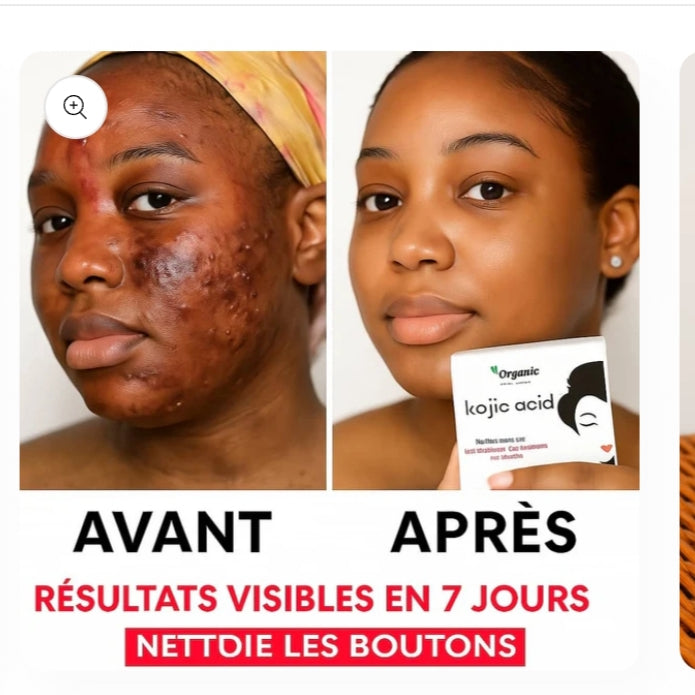 Savon Kojic Éclat Naturel – Ta Peau d’une Douceur Lumineuse, Éclatante et Lisse