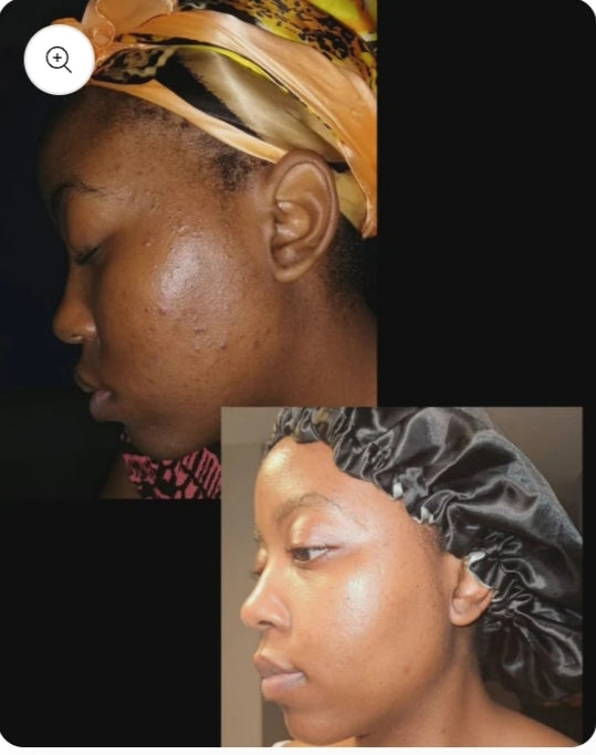 Savon Kojic Éclat Naturel – Ta Peau d’une Douceur Lumineuse, Éclatante et Lisse