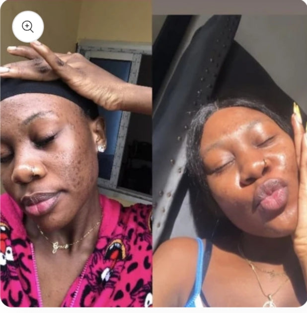 Savon Kojic Éclat Naturel – Ta Peau d’une Douceur Lumineuse, Éclatante et Lisse
